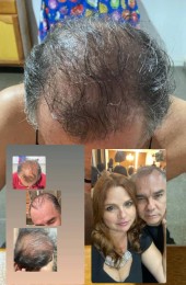 Colágeno Pele Cabelo Unhas Jaru Promoção — foto 8