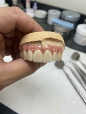 Excelência em reabilitação oral e estética dental.